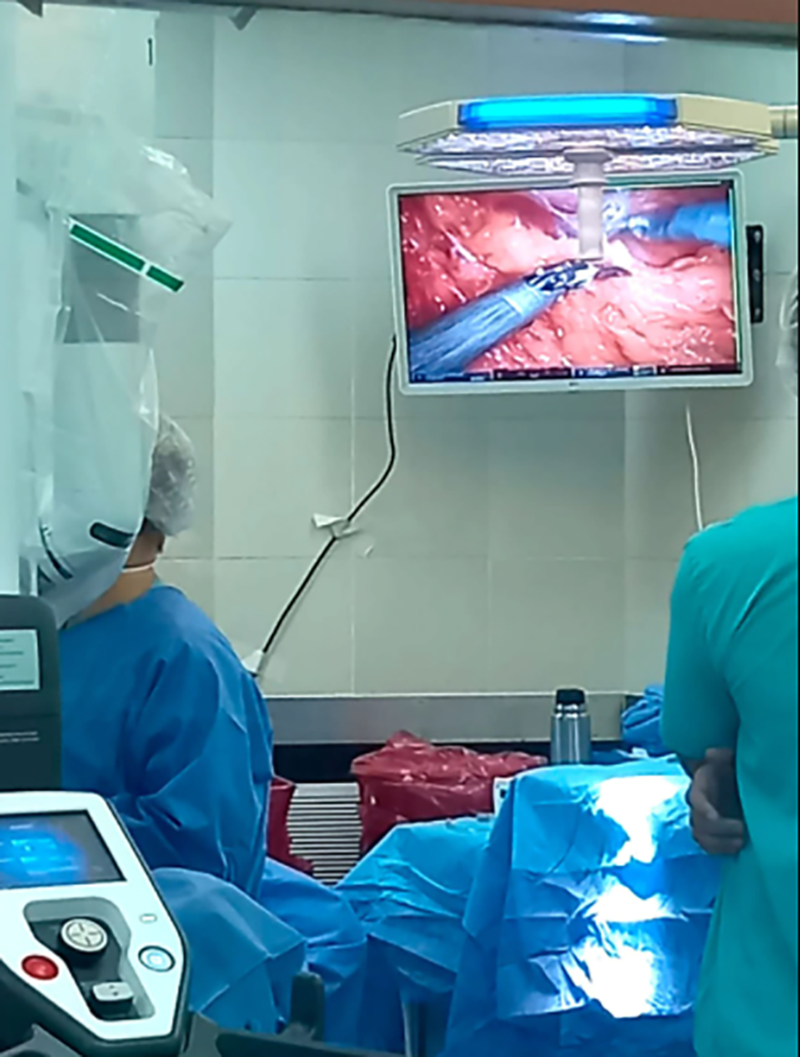 La cirugía robótica permite realizar intervenciones con altísimo nivel de seguridad y precisión (Hospital de Clínicas)