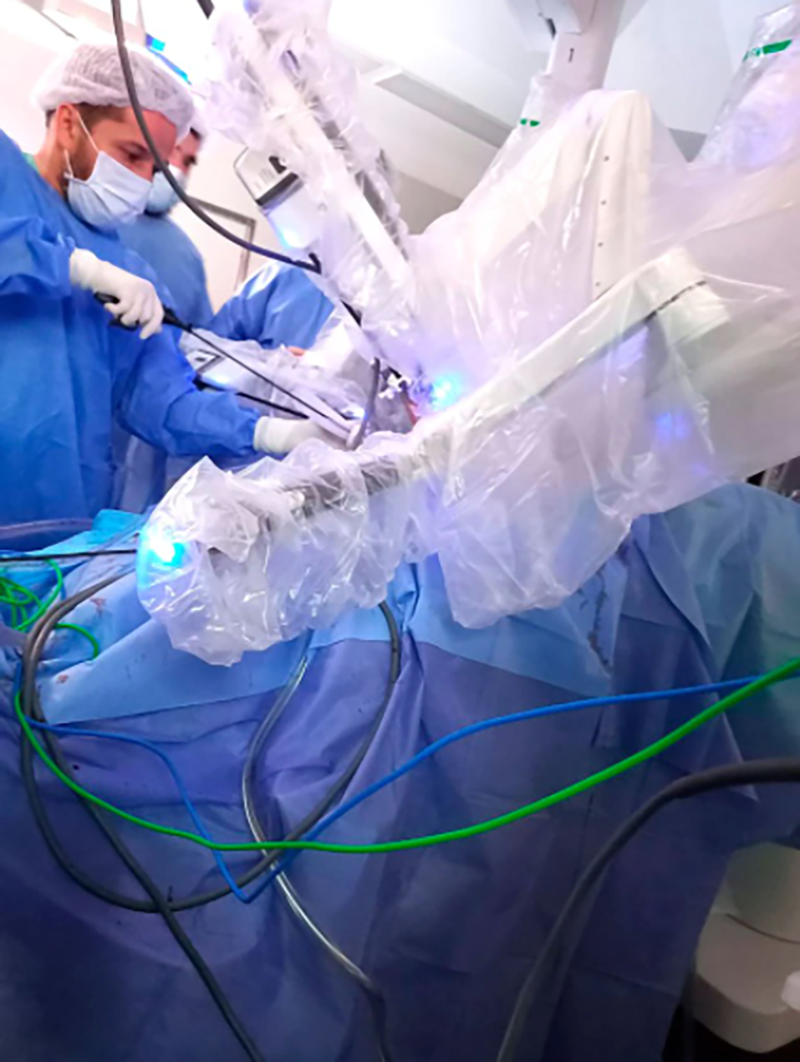 Son muchas las ventajas de una cirugía robótica: optimización de una sola anestesia, una sola internación, un solo estrés (Hospital de Clínicas)