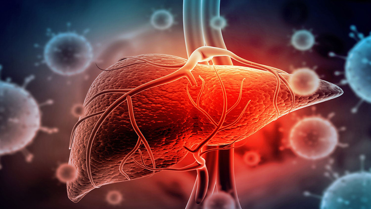La Hepatitis, un Desafío Invisible